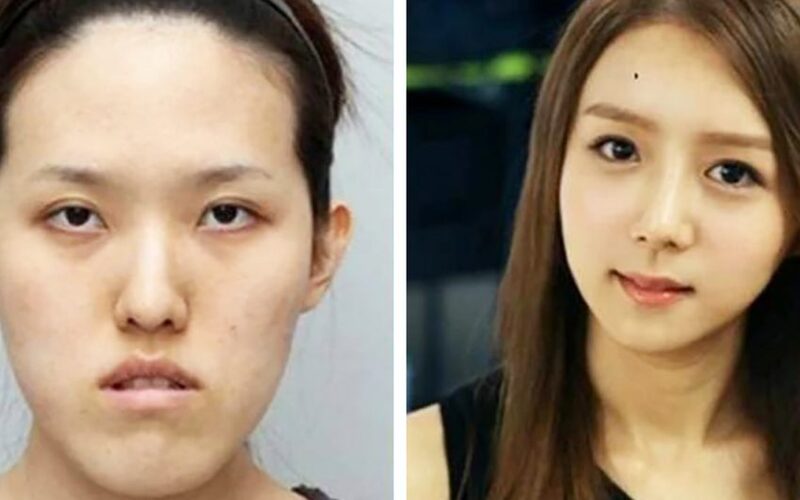  .“Is it the same person?” As a result of the plastic surgery these people from South Korea became unrecognisable