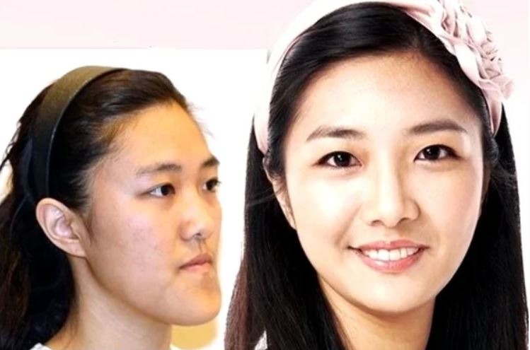 What miracles can the Asian plastic surgeons do? 