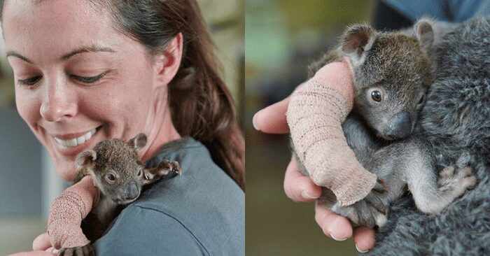 Fascinating scene: luckily this wonderful little koala with a broken leg was saved in Australia