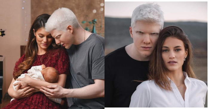  The most beautiful albino singer with a unique appearance has a baby: here’s what the baby looks like