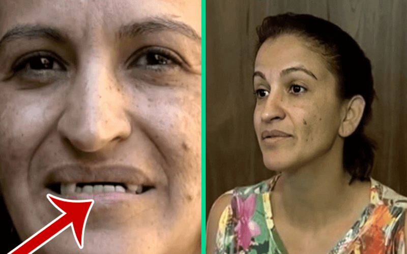  “Age spots, acne, toothless mouth.” After the transformation, the woman was not recognized by her own daughter