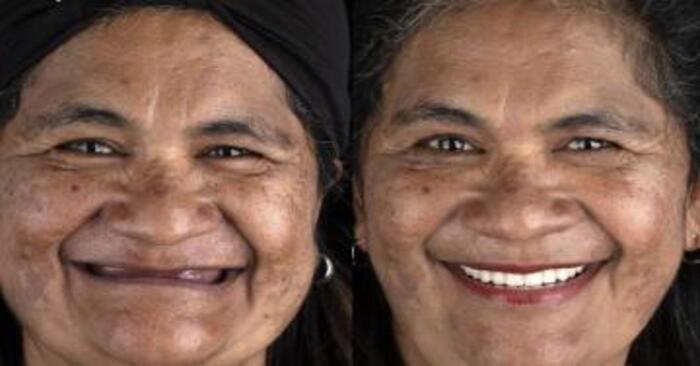  Wonderful story: this kind dentist returns beautiful teeth to people who can’t pay