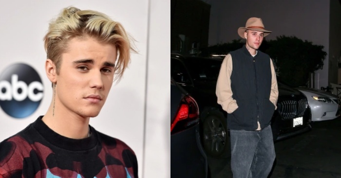  Famous Justin Bieber’s first smile after rare facial paralysis: here are new photos of celebrity