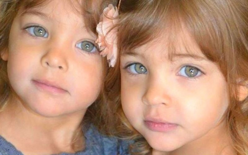  What are the most beautiful twins in the world who are famous from birth?