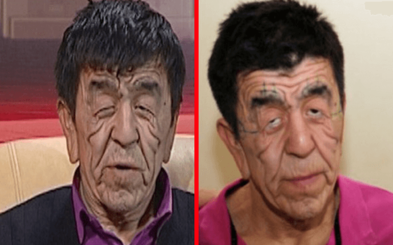  What does a guy from Kazakhstan with the face of an old man look like after operations to change his appearance
