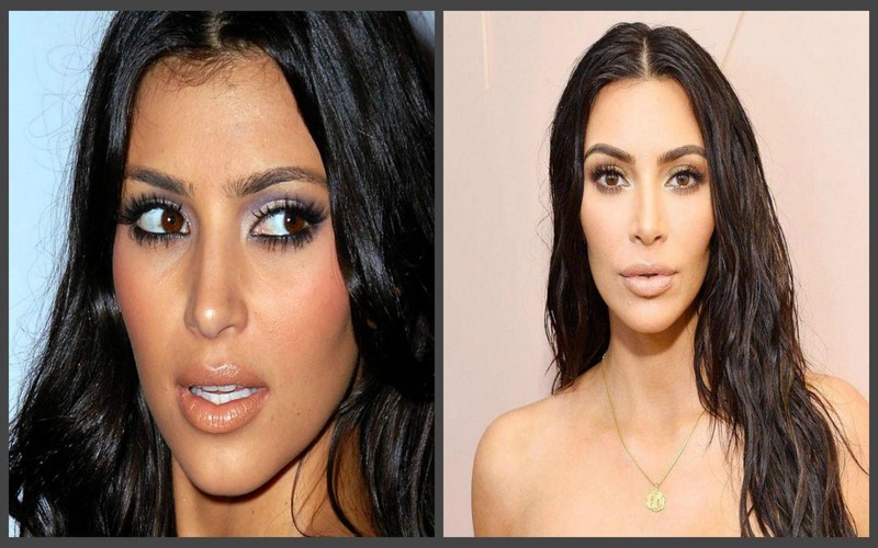  “She used to be very cute”: What did Kim Kardashian look like before plastic surgery?