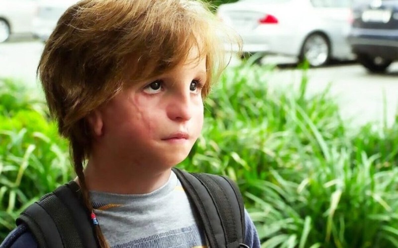  How does the boy from the film “Wonder” look like now and what does he do?