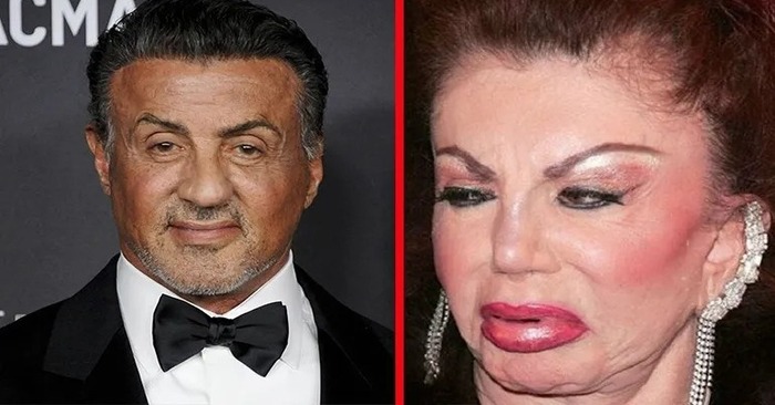  You’d be surprised to see what plastic surgery has turned Sylvester Stallone’s mom into