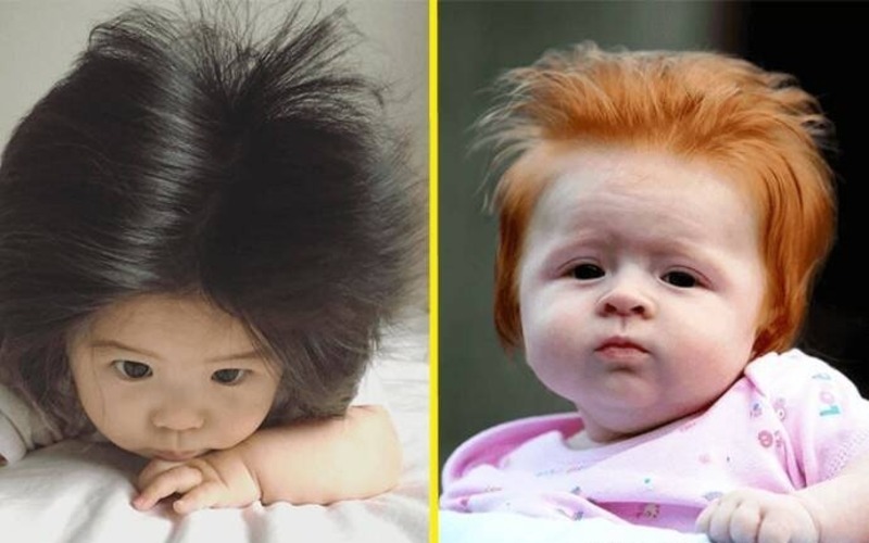  What do the children who were born with gorgeous hair look like now?