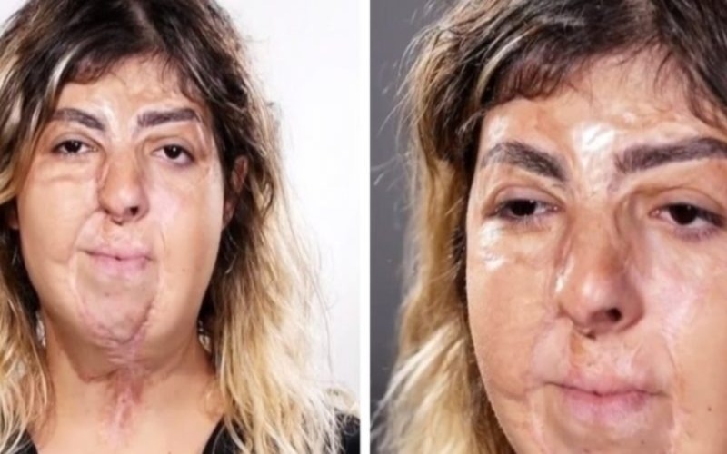  Makeup artist with an extraordinarily talent could change one’s life. Look at this unbelievable transformation