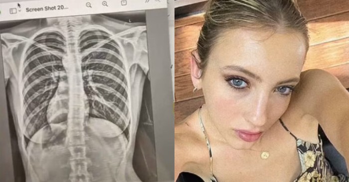  What news: when this girl took an x-ray, she found out that people like her are less than 1% in the world