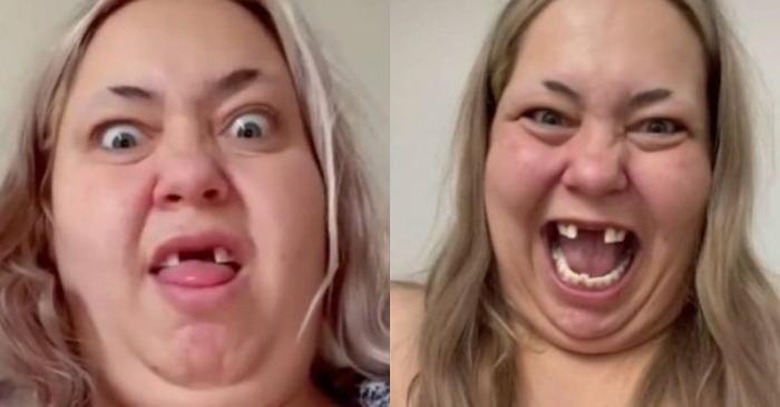  «Unbelievable, that she is the same girl»: a blogger without teeth conquered everyone with a transformation
