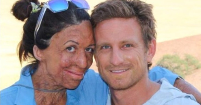 Life full of love: Turia Pitt shows her powerful real love story after survival