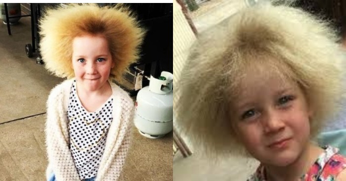  The dandelion girl conquers with her appearance: a girl from Australia with naughty hair syndrome