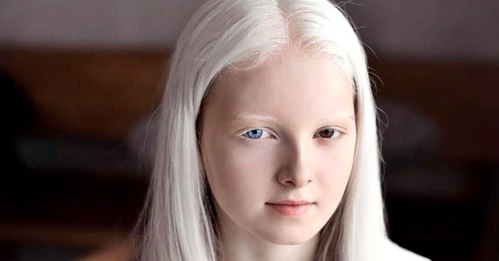  Unearthly appearance of the11-year-old girl: this unique girl should have a modeling career