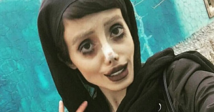  «She has already become similar to a zombie»: the girl survived 50 plastic surgeries to become like Jolie