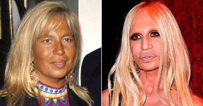 «Plastic surgery ruined their appearance»: they cannot be recognized ...